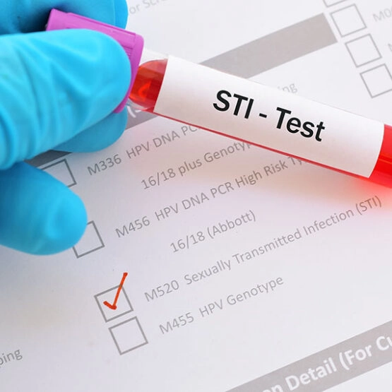 STI Test für zu Hause